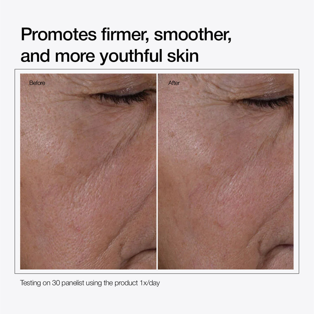 Multi-Peptide + HA Serum